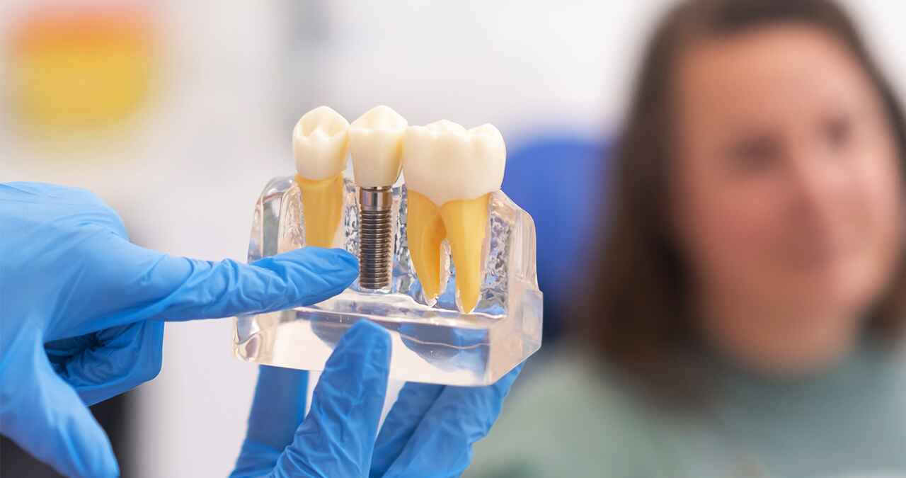 How Long Before Dental Implants Feel Normal? Your Recovery Timeline